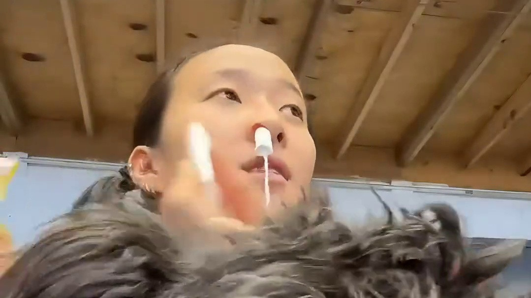 为什么有的人舌头上也能长牙齿