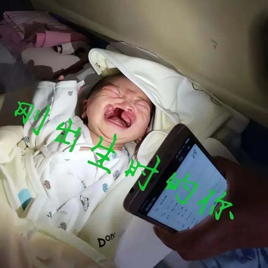 99%的网友只知道捐款献爱心，却不知道嫣然医院到底有多牛？为什么它无可取代，