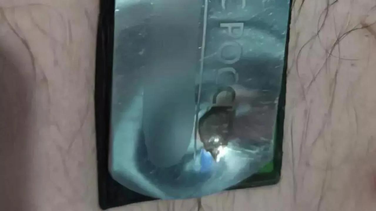 战场上总有人的运气很好。据俄罗斯卫星通讯社报道，一名呼号“鞑靼人”的俄军士兵在顿