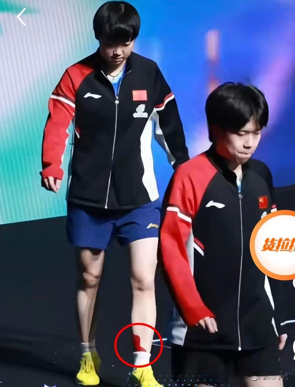 莎莎崴脚我不吃惊，刚退也是很正常，但是我没想到混双他又回来了！刚看到莎莎