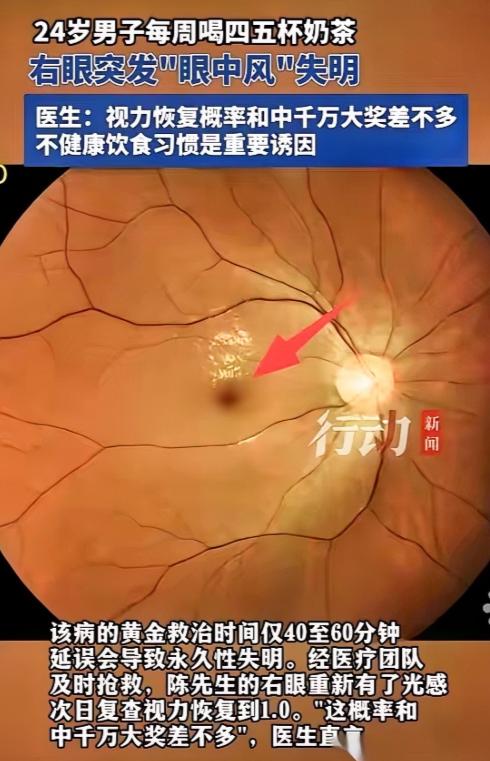 “悲剧还是发生了！”福建福州，一24岁男子没有基础病，但就是喜欢喝奶茶，每周都要