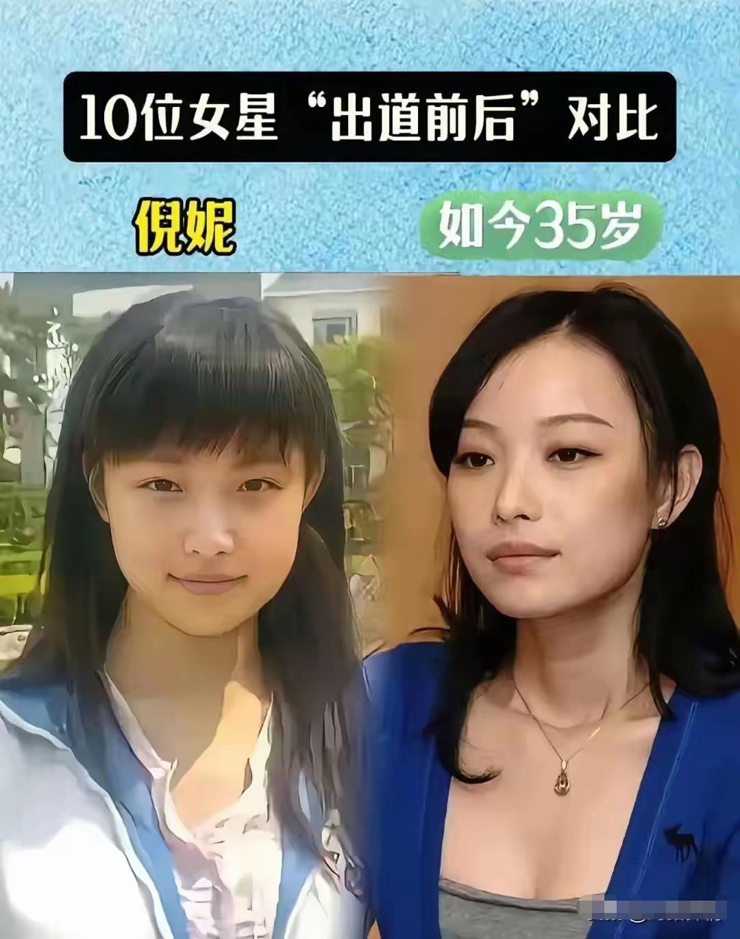 有没有发现一个有趣的现象，很多女星成名之后，颜值仿佛悄悄升级。明明还是同一个人，