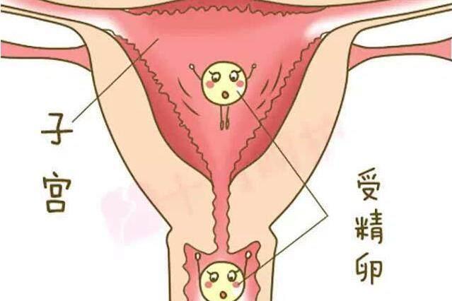 什么是孕期生化妊娠, 对身体有什么影响?