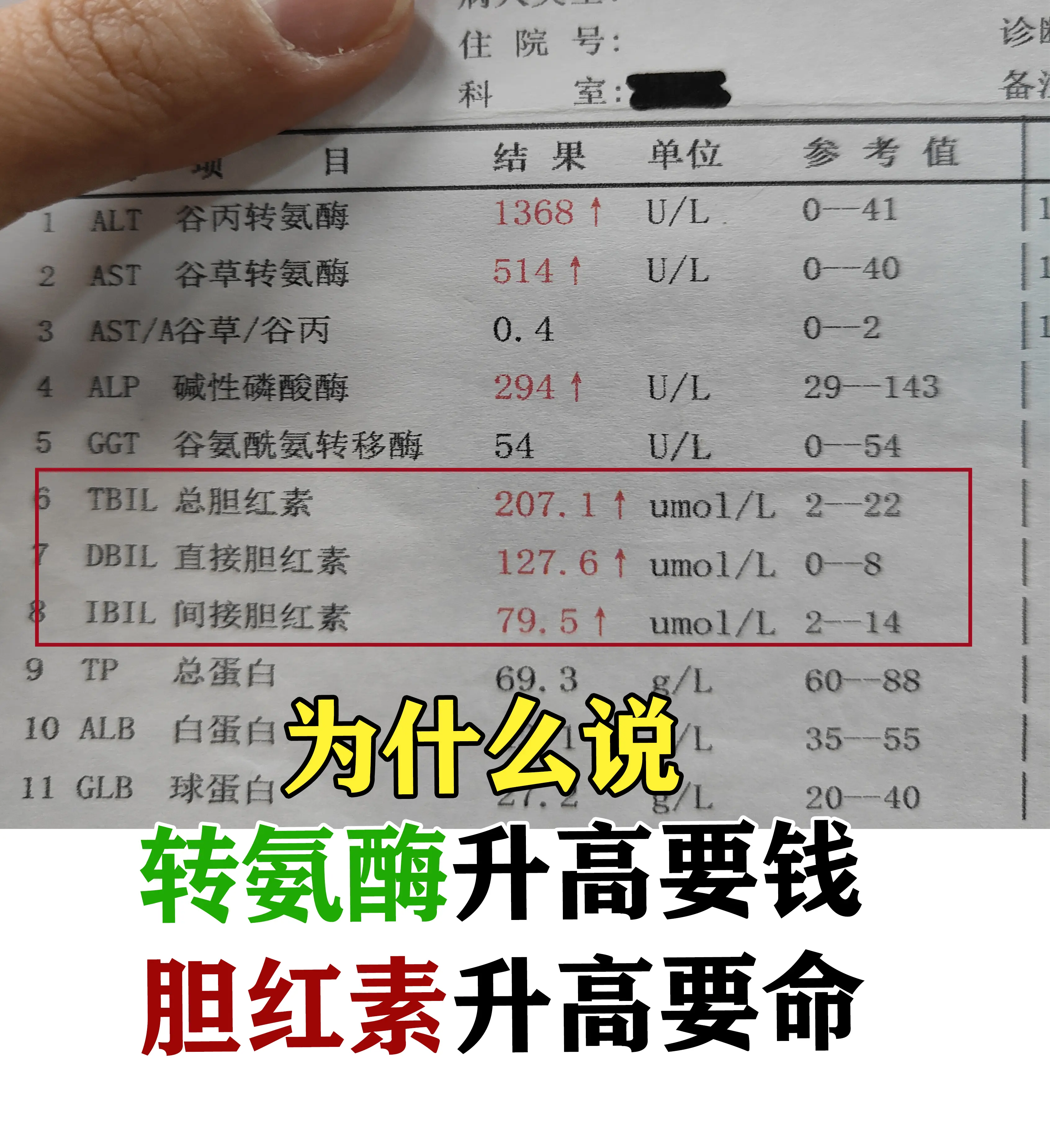 小伙子，你这是病毒性肝炎急性发作，你出现的乏力、黄疸等症状，也就好解释...