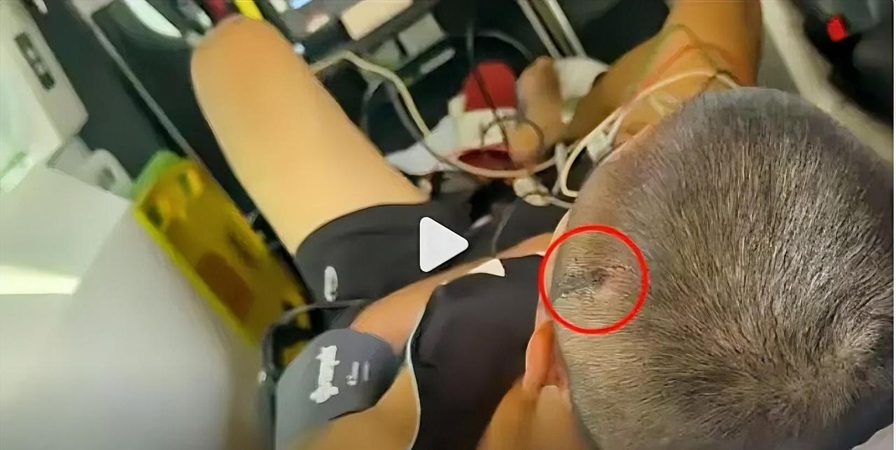 一个华人拳击手，被几个澳大利亚小烂崽打得快死了，我觉得挺丢脸的。刚看一个