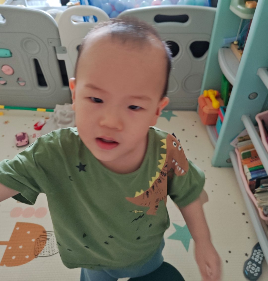 孩子头发长得不好，来医院开个药​​​