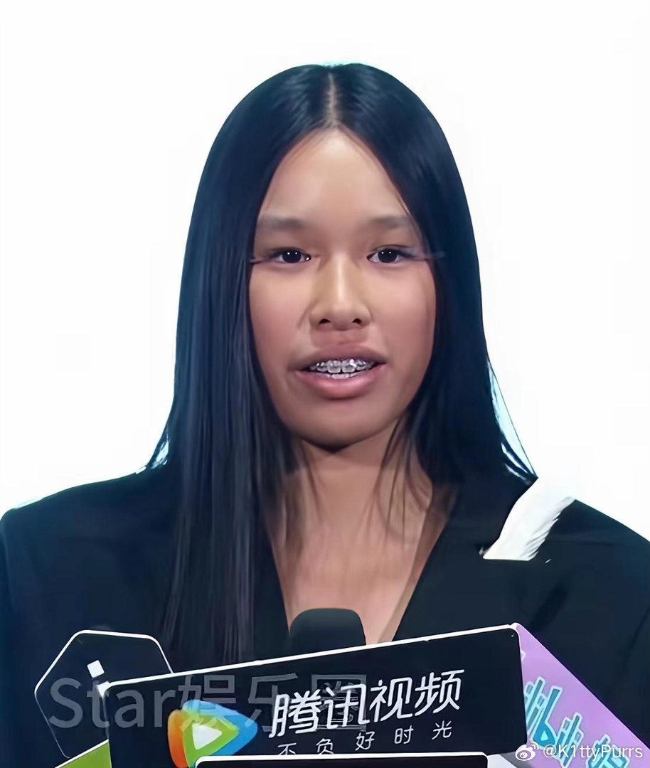 果然还得是有钱人会养娃，这长相在国内没有市场吧！