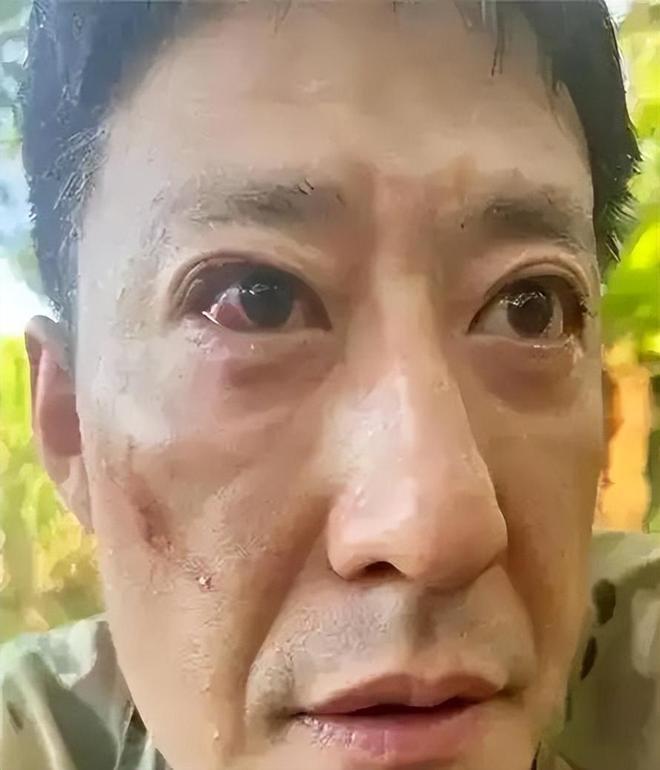 2010年的一天，于震抄起手边的凳子就砸到了怀孕妻子方柏霓的身上，哪怕躲避及时，