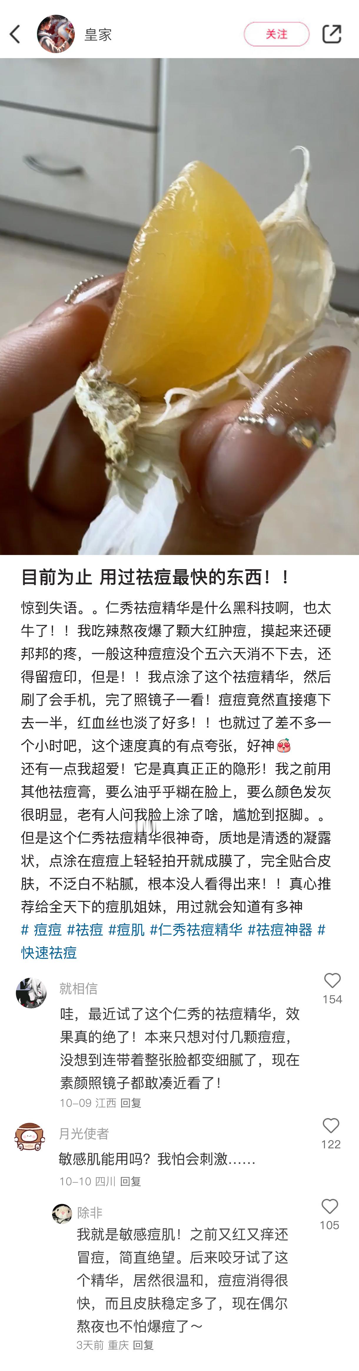 是真的！大家喜欢在网上找答案的原因找到了！