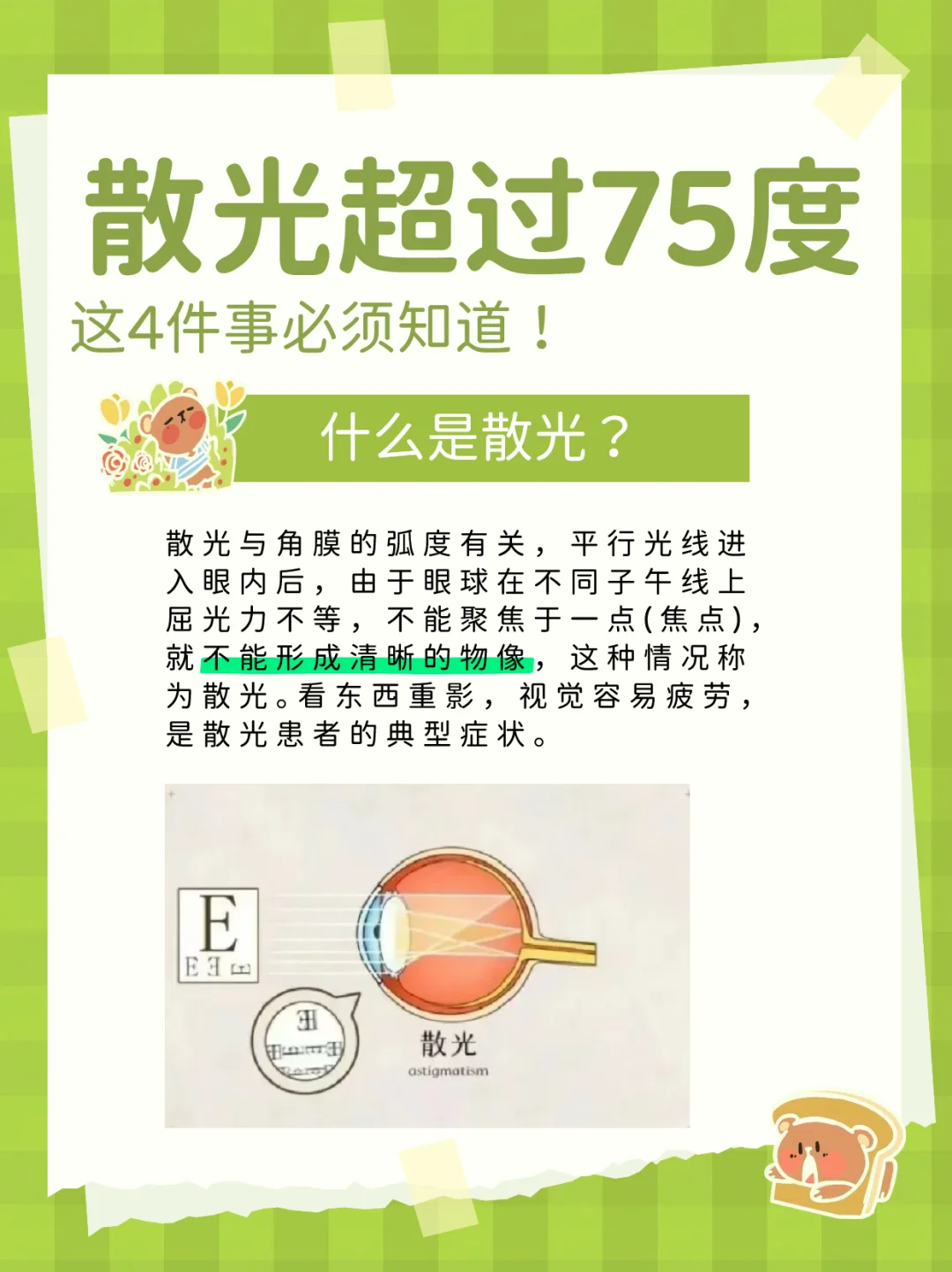 散光超过75度？这4件事你必须知道！