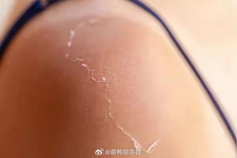桑拿天里这些情况要注意身上湿黏黏，体内却快脱水了！桑拿天身体正在极限拉扯。喝水要