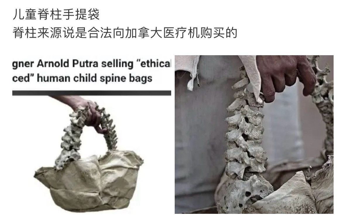 美国斩杀线现象儿童脊柱手提袋。。？