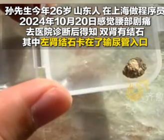 “这是个狠人”！2024年10月上海一男子突然腰部剧痛，去医院一查，发现双肾都有