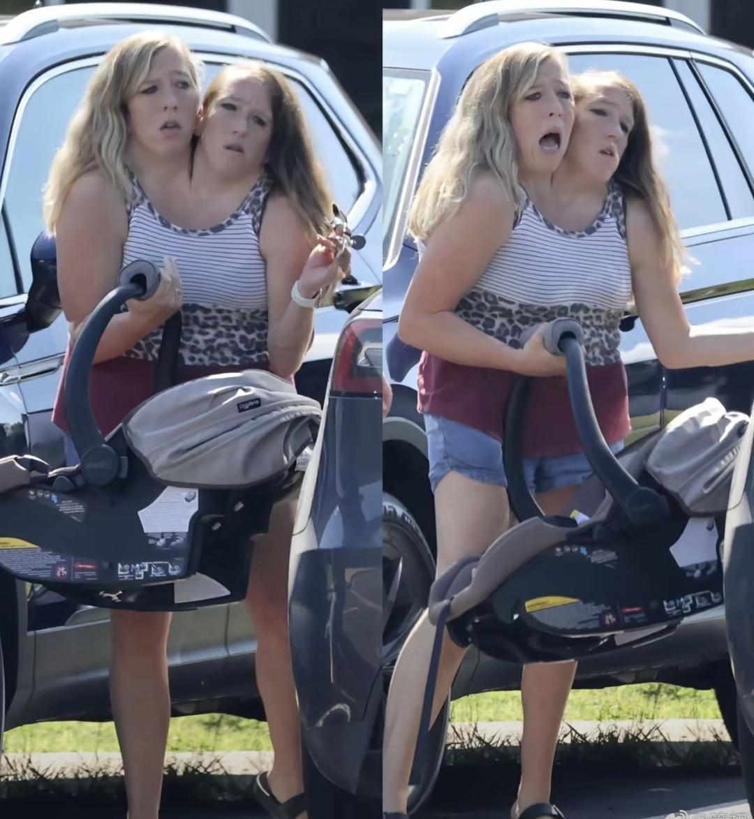 艾比和布列塔尼是连体双胞胎，出生在明尼苏达州。州政府给她们各自发了出生证、驾照、