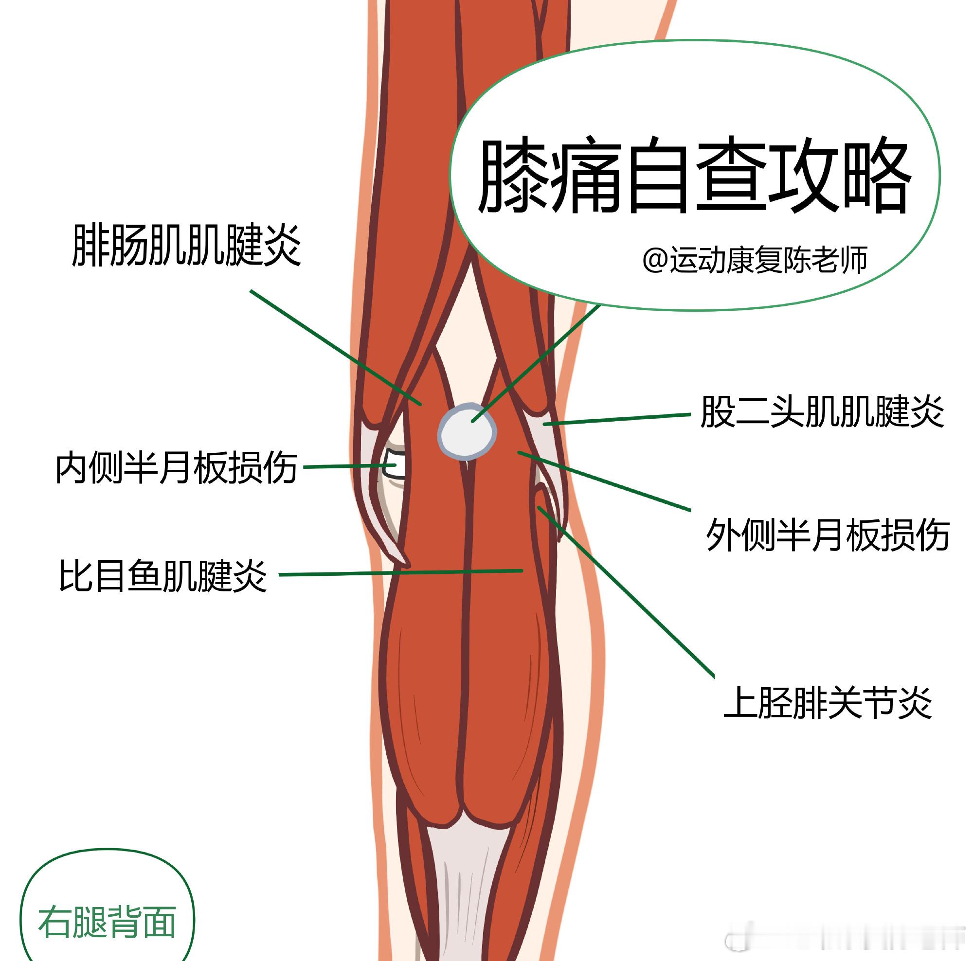 膝盖后侧疼的原因找到了膝盖前侧讲过很多了，今天来把这份膝盖后侧的损伤盘点，整