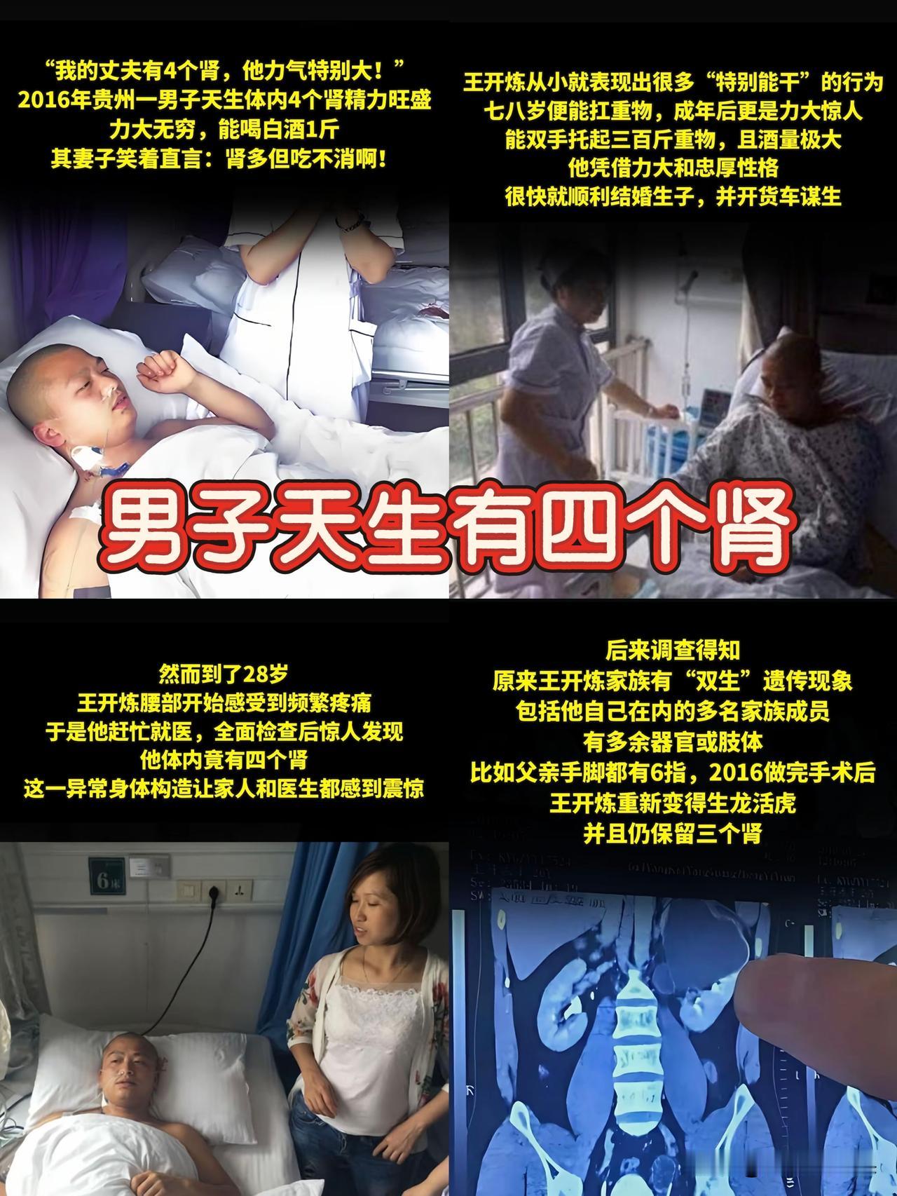 你们相信吗？有人天生就带着“顶配”器官——贵州的王开炼，就因为腰疼去医院检查，查