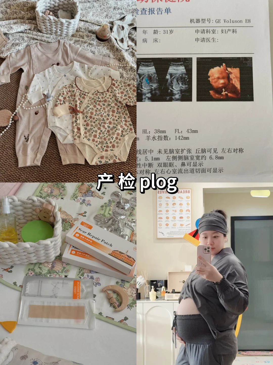 孕期plog | 产检日📅初次和宝宝见面好开心