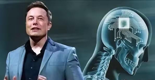 马斯克又一天才创举惊艳世界，脑机接口将终结肉身残缺！而且今年就要量产！​什么概