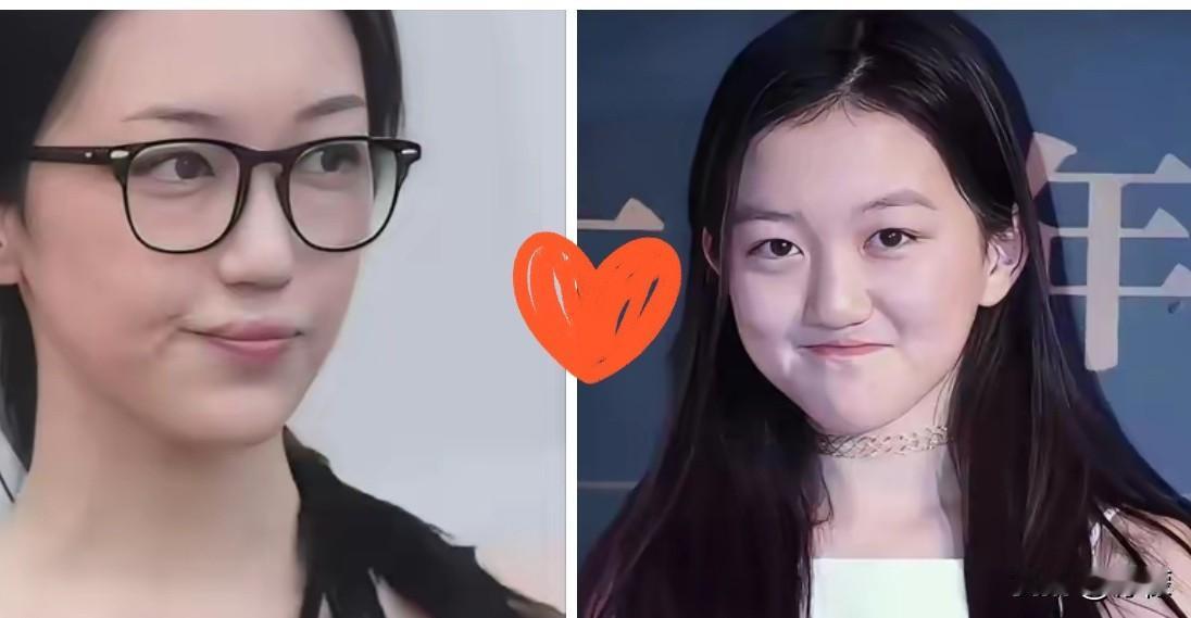 现实太扎心！唇腭裂修复的顶级效果，本质都是金钱堆出来的底气不得不承认，成年