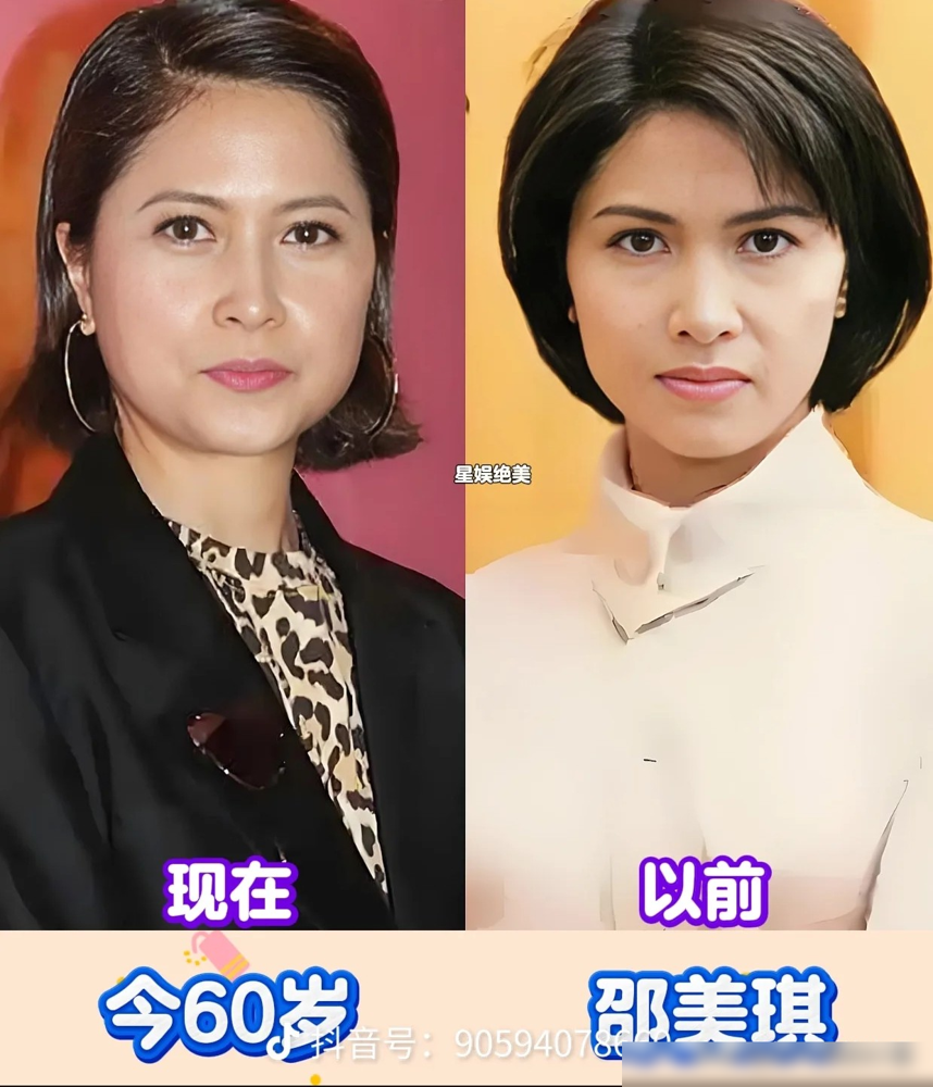 65岁惠英红，一年到头十个月泡在片场，腰疼、腿伤、鼻子断了全靠嘴喘气，就是不肯停。刚拿下华表奖影后，
