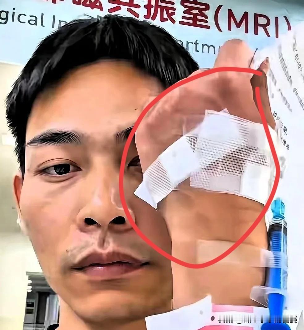 看哭了！佛山这位潘先生真的太让人动容，肝癌晚期化疗后本就虚弱到极致，却拼着命救下