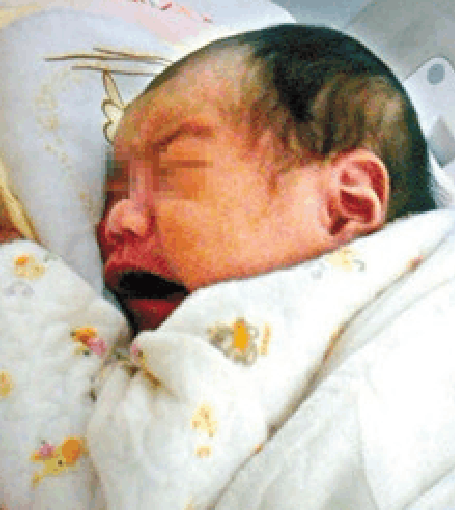 二胎宝妈为保胎狂打保胎药, 孩子出生后, 却后悔莫及