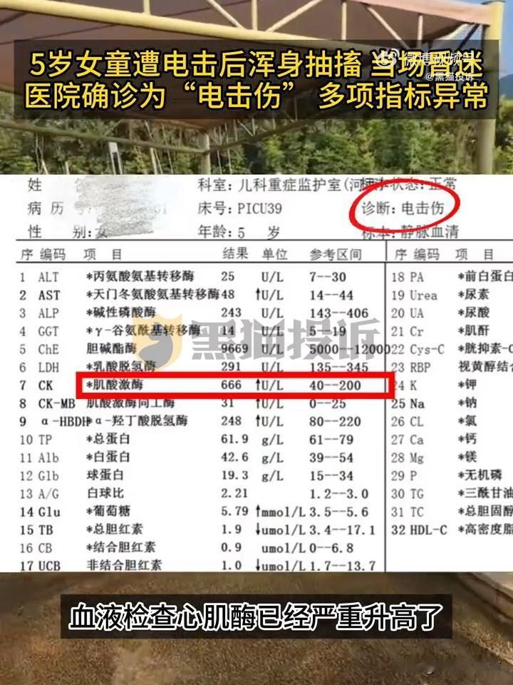 5岁孩子在游乐园遭电击受伤，为何园区矢口否认？近日，南京李女士带着5岁女儿在