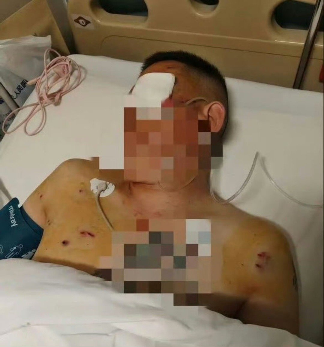 取170万银行门口遭抢男子发声大家现在信赖保安吗我感觉有事还得是立马报警好！