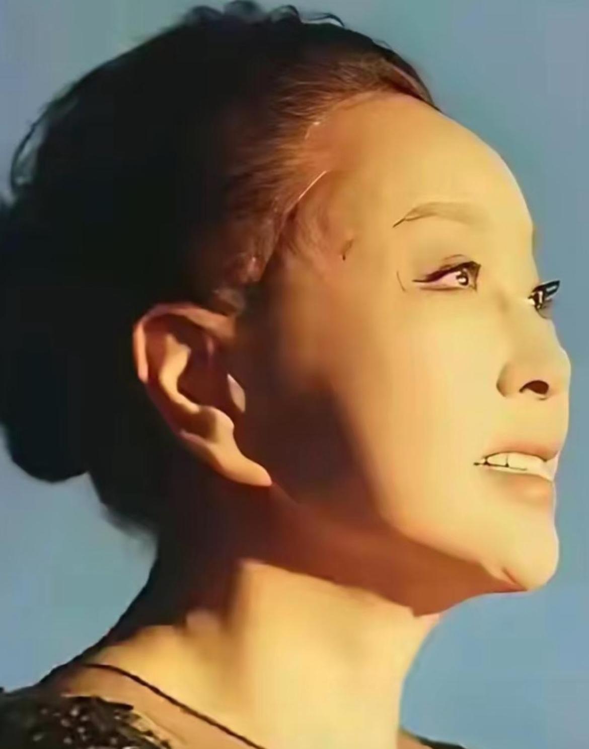 70多岁的人，拉皮后会怎么样？就像庆奶这样，不得不天天戴假发遮掩。老了就是老