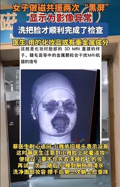 解释不清了！福建一29岁女生头晕，去医院做头颅磁共振。不料，连续2次扫描，都因面