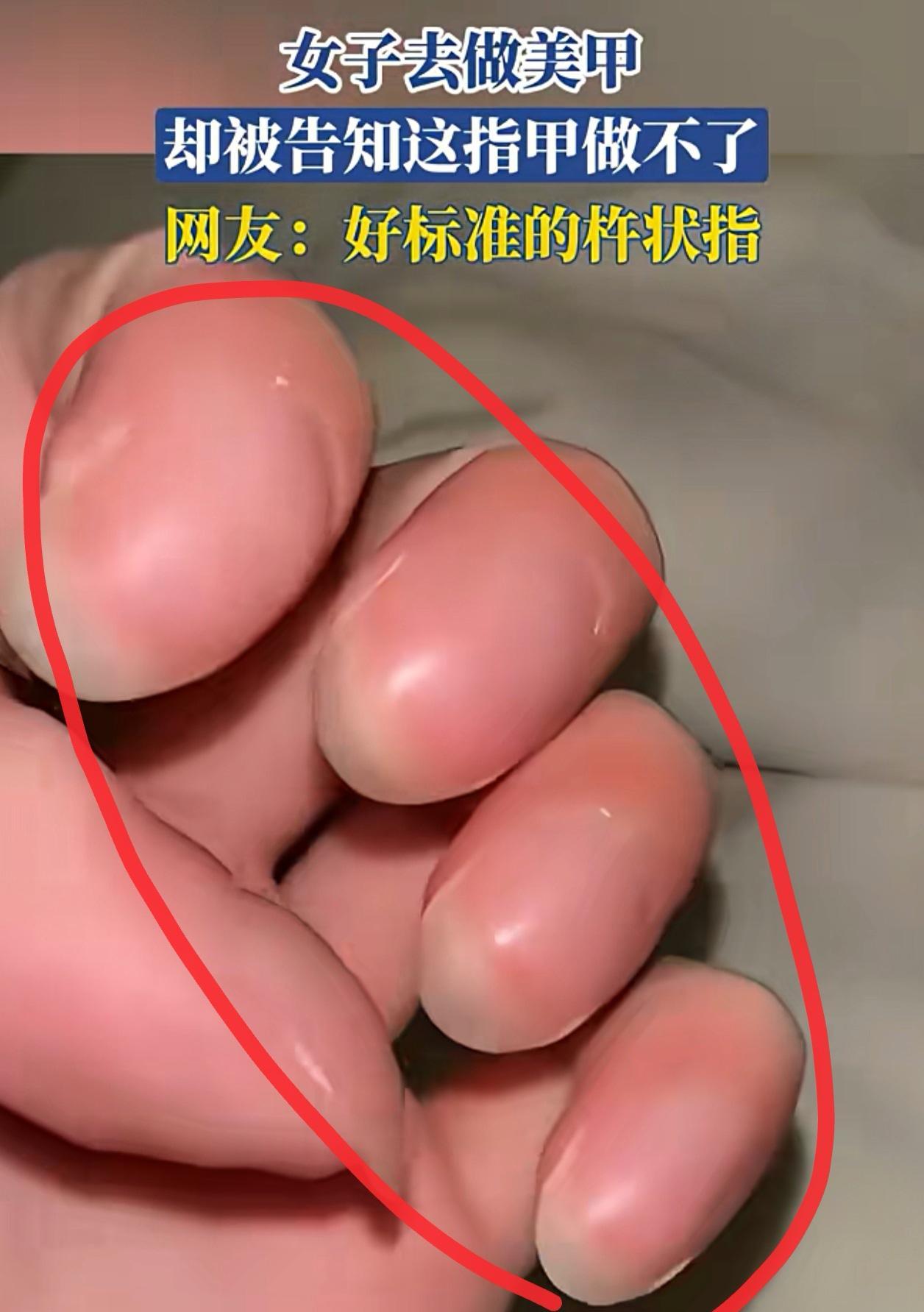一女子去做美甲，手刚伸出来，美甲师脸色都变了：“做不了”！近日，一位