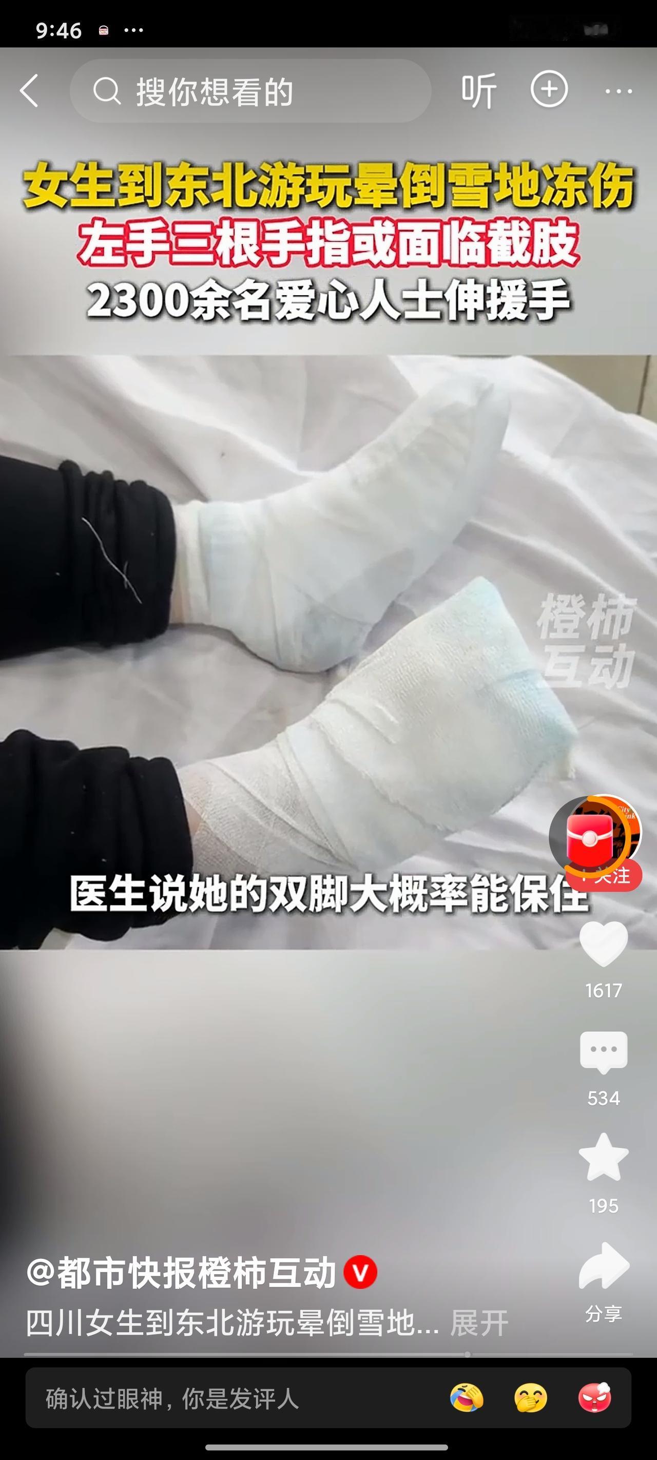 揪心！四川女大学生东北看雪，冻伤恐截3指21岁四川音乐专业女生，独自去东北