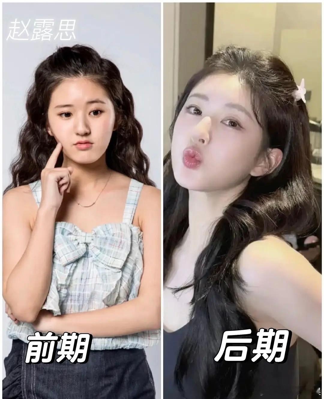 大家觉得早期的赵露思和后期的赵露思有区别吗？