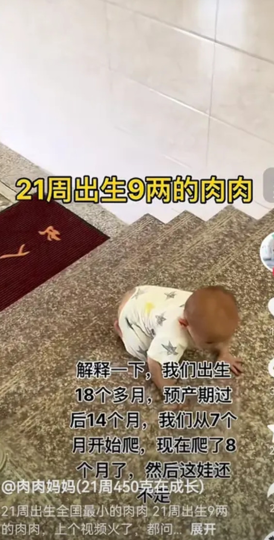 都说互联网是有记忆的。果然，那个21周出生9两的肉肉被找到了！肉肉麻麻发了视
