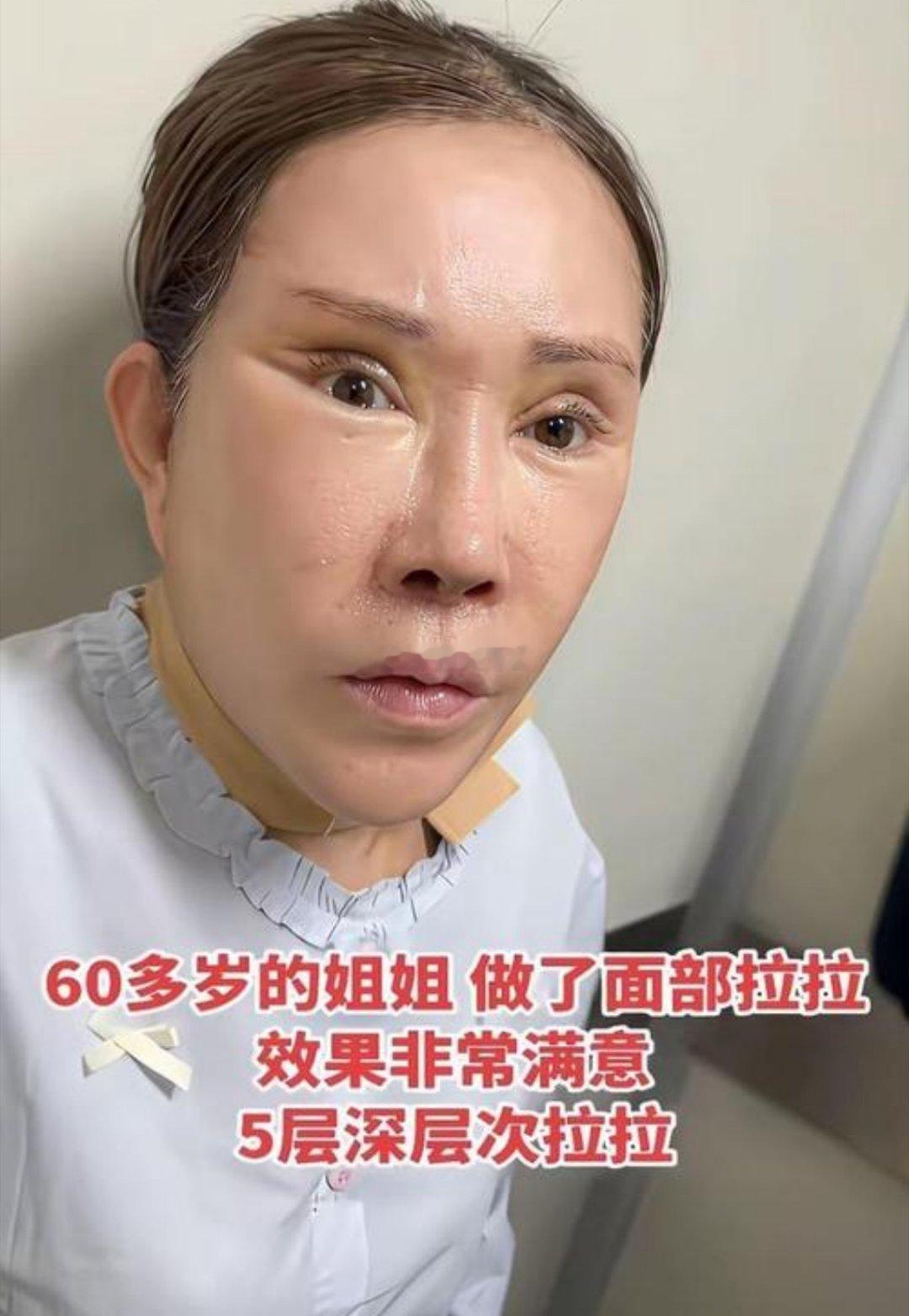 追求美，没有什么错。没有一丝皱纹，满满的胶原蛋白