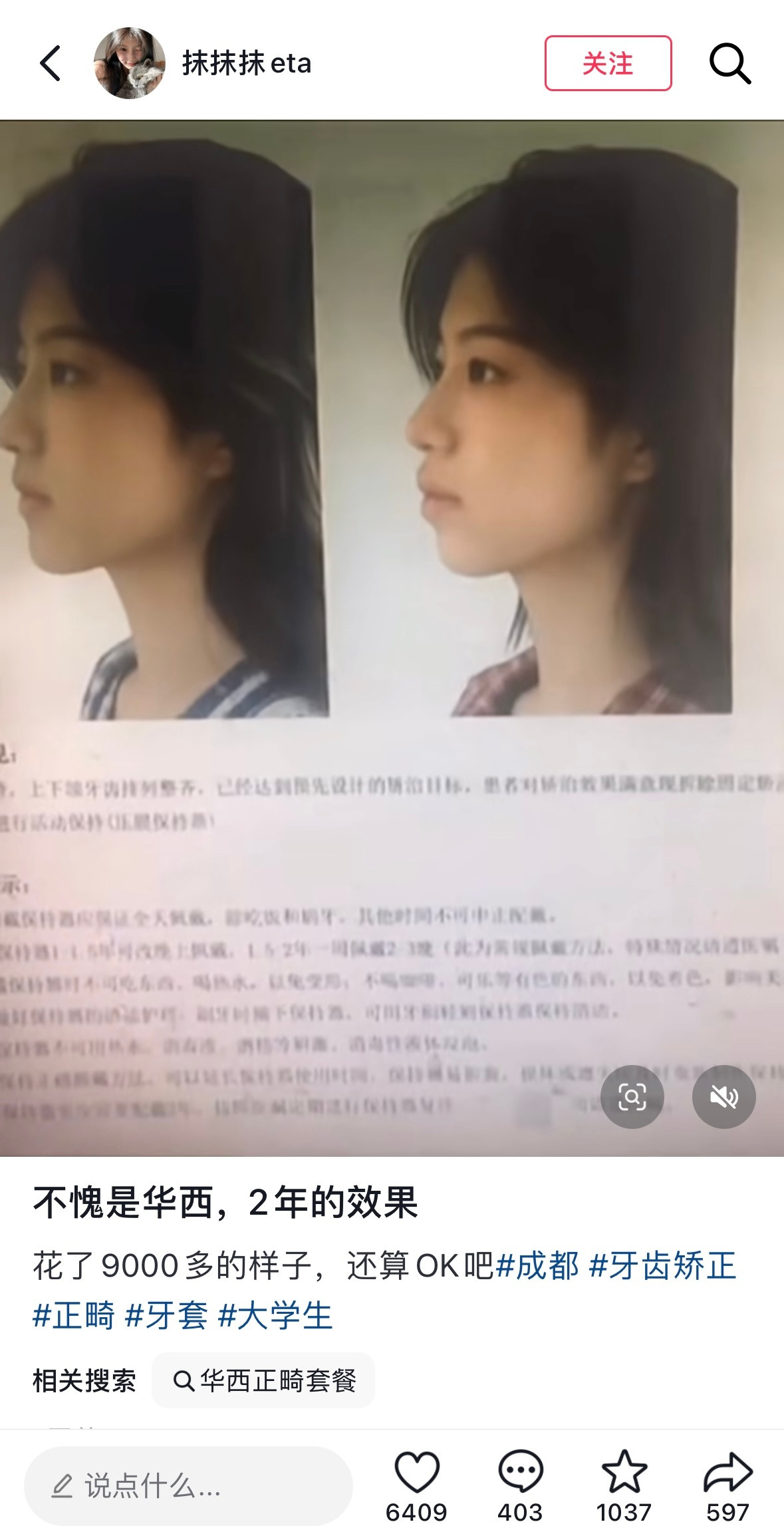 关于正畸的这个真的算是逆天改命了….