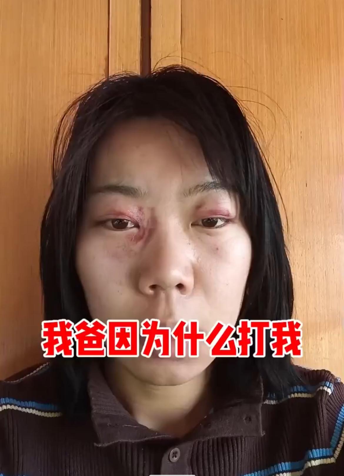 女子吐槽，因为自己坚持不婚主义，被亲爸殴打，妈妈不管，弟弟不劝，奶奶指着鼻子骂，
