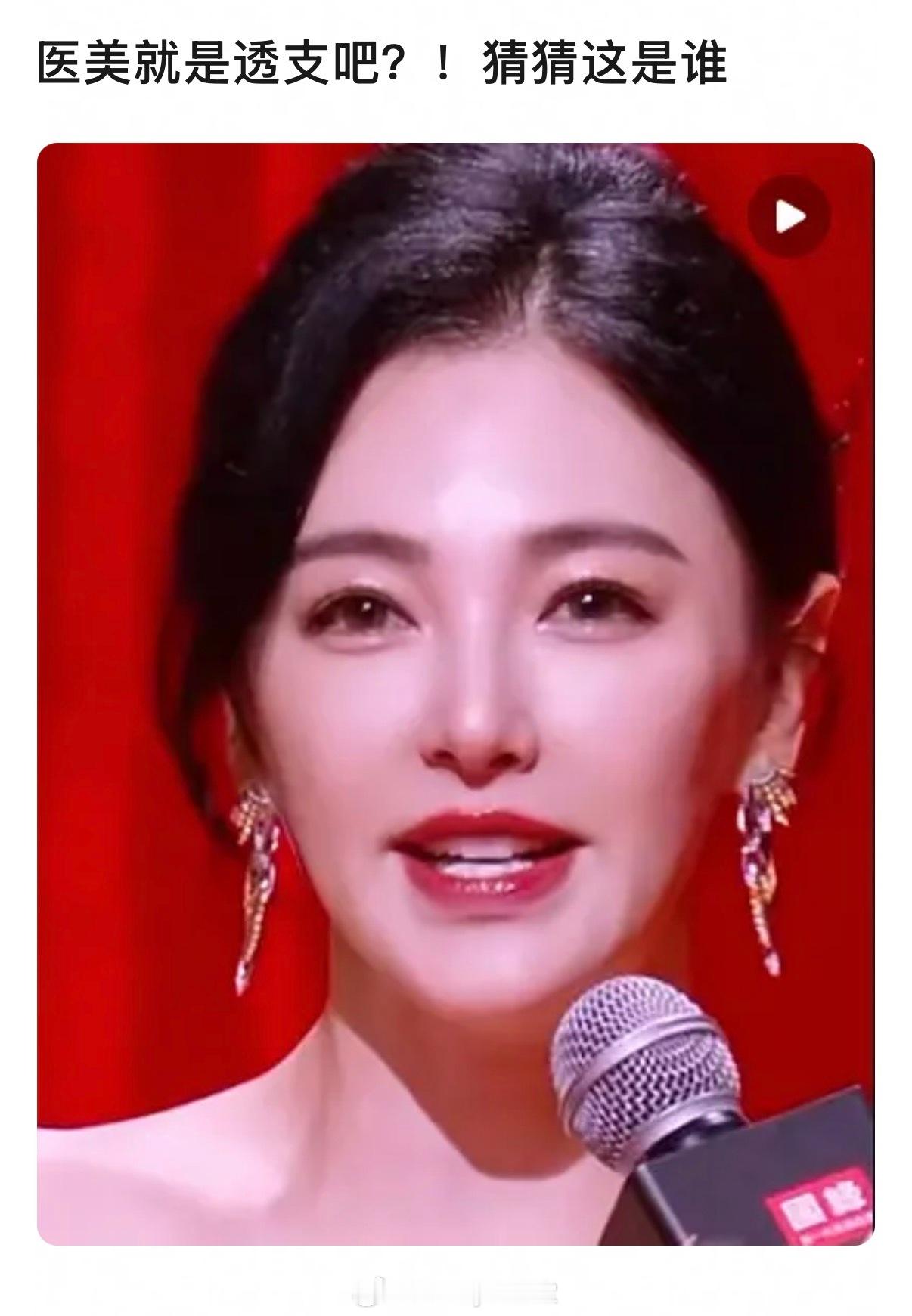 这竟然是张雨绮，她对自己美丽的脸做了什么……乍一看都没认出来