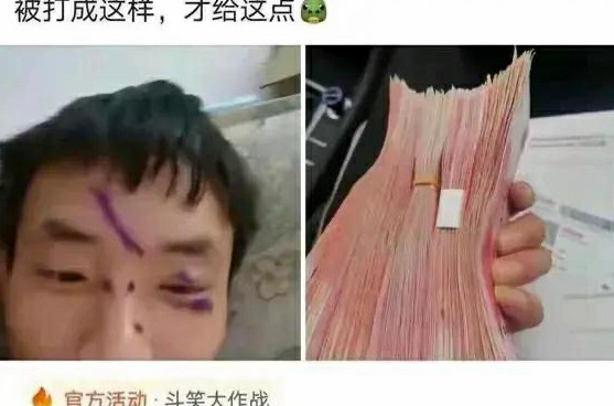 挨打能赚这么多？？这看着也没多大事啊