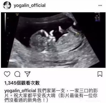 林宥嘉自爆老婆怀男宝! 生男生女如何早知道?