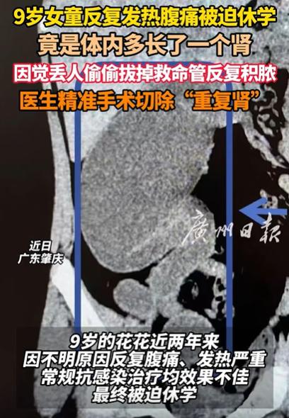“解释不清了！”广东，9岁女孩反复发热腹痛，被迫休学！去医院检查，竟然发现女