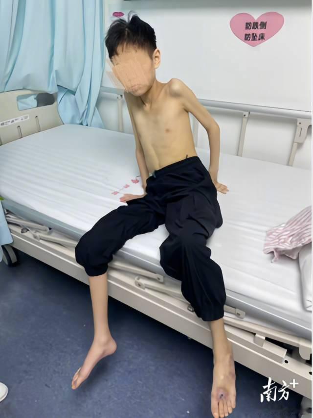 【 “做完之前的手术后，身体更差了，反反复复，看过很多医院都查不出是什...