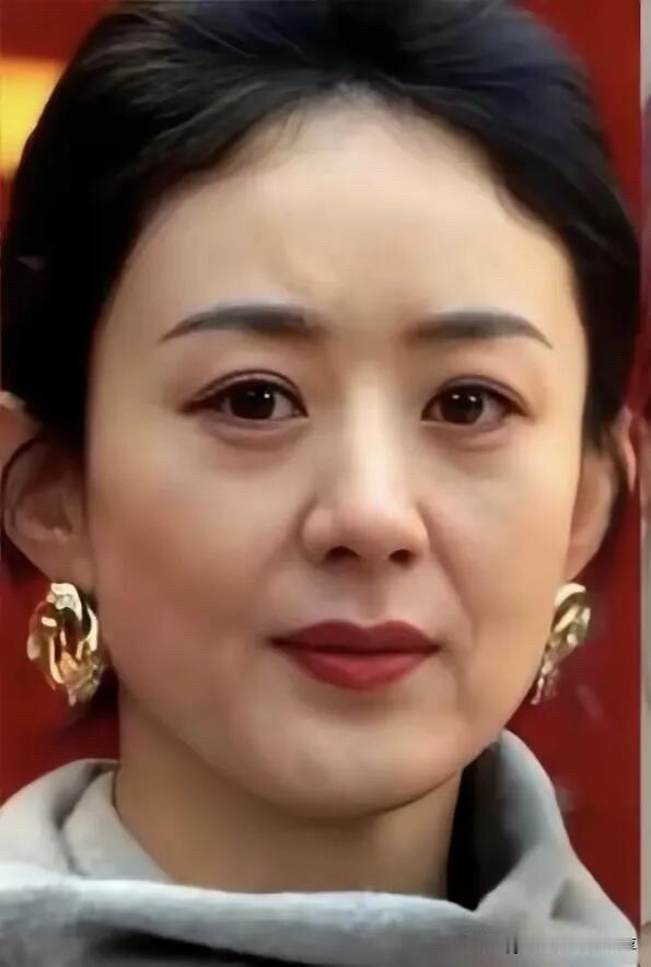 她的颜值呈现出断崖式的衰老，还不到40岁脸上的法令纹特别的深，眼袋深，皮肤有点松