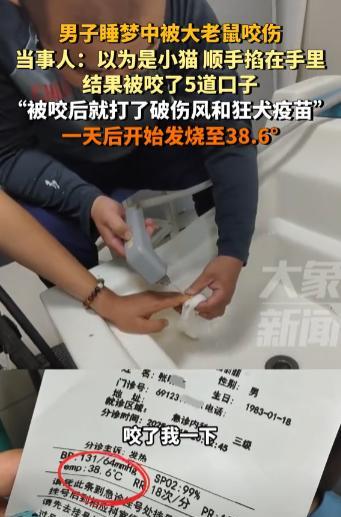 太可怕！江苏无锡，男子晚上在家睡觉，半夜迷迷糊糊地感觉手上有什么毛绒绒的东西在动
