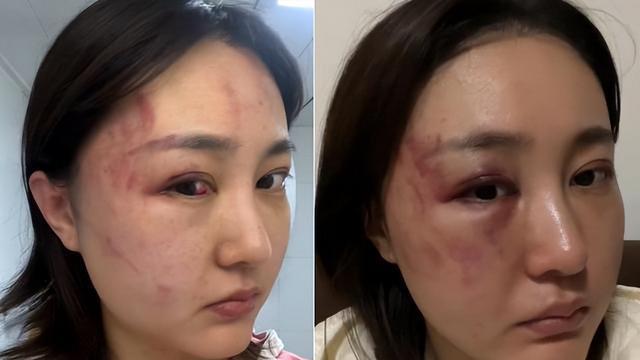 52岁女星被丈夫当街家暴，男方狂踹其腹部，“最强美魔女”晚年生活如此凄惨曾经，