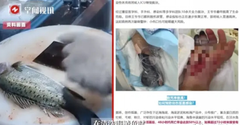 “差点把命搭进去！”6月11日报道，一88岁的大爷在家里处理海鲈鱼，右手不小心被