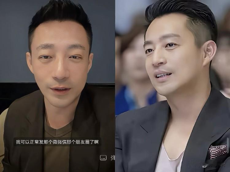 汪小菲割个双眼皮，怎么把中年男人的体面都割没了？最近汪小菲的“眼皮子工程”成了