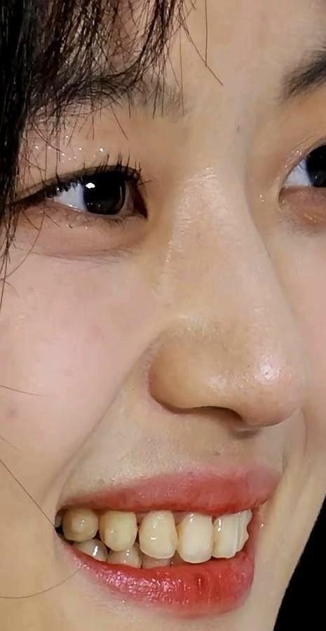 孙千在巴黎CELINE秀场被外媒生图怼脸，评论区全在盯她那口原生牙。旁边人头排坐着牙白得反光，她愣是