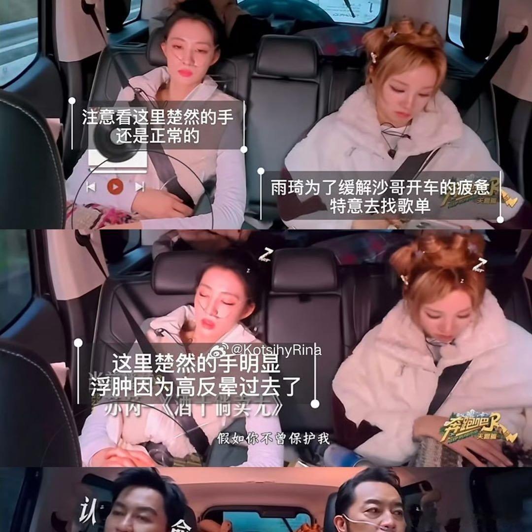 王楚然手肿了王楚然的手浮肿看到我好生气