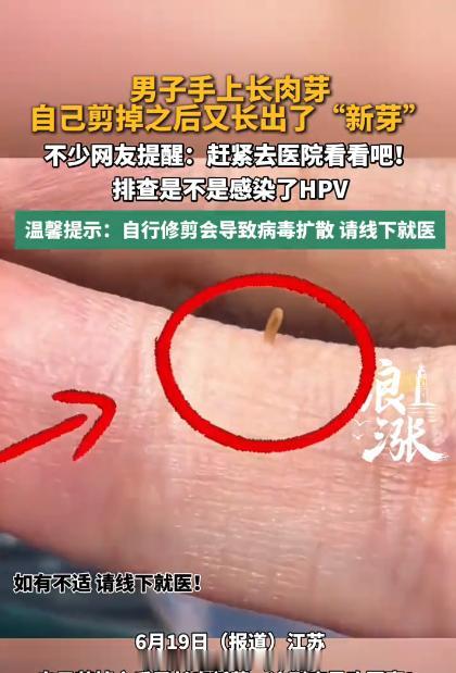 悲剧还是发生了！江苏南京，一男子手背上莫名冒出个小米粒大的肉色小疙瘩，不痛不痒但